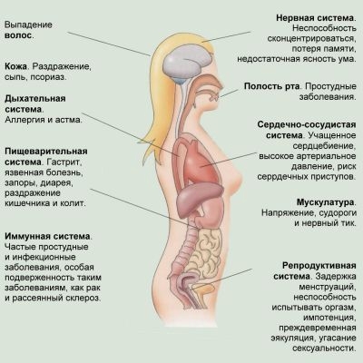стресс стресс