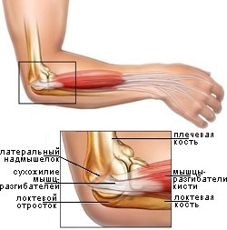 фехтование фехтование