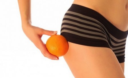 Донимает «апельсиновая» корка? Невероятно эффективная диета от целлюлита