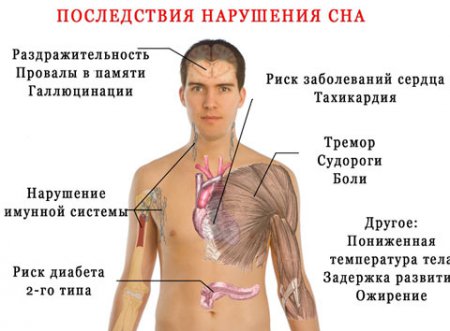 причины бессоницы